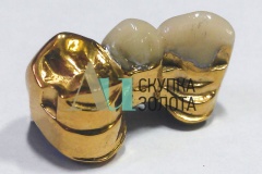 Позолоченные зубы