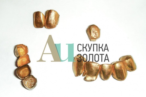 Коронки из золота